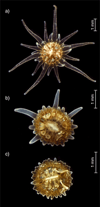 Image from the paper Rädecker, Nils & Chen, Jit Ern & Pogoreutz, Claudia & Herrera, Marcela & Aranda Lastra, Manuel & Voolstra, Christian. (2019). Nutrient stress arrests tentacle growth in the coral model Aiptasia. Symbiosis. 78. 10.1007/s13199-019-00603-9.