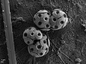 A microscopic image of Coccolithophores